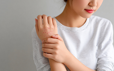 재발 차단 구조